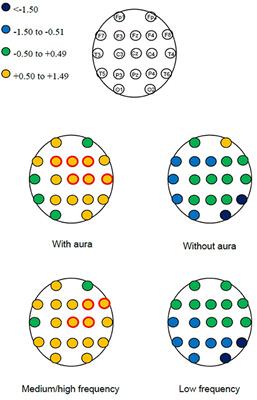 Different effects of air microembolism through patent foramen ovale in patients with migraine: A quantitative electroencephalogram case series